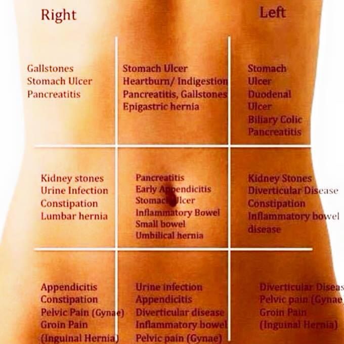 Stomach pain chart which helps you to guess whats going on